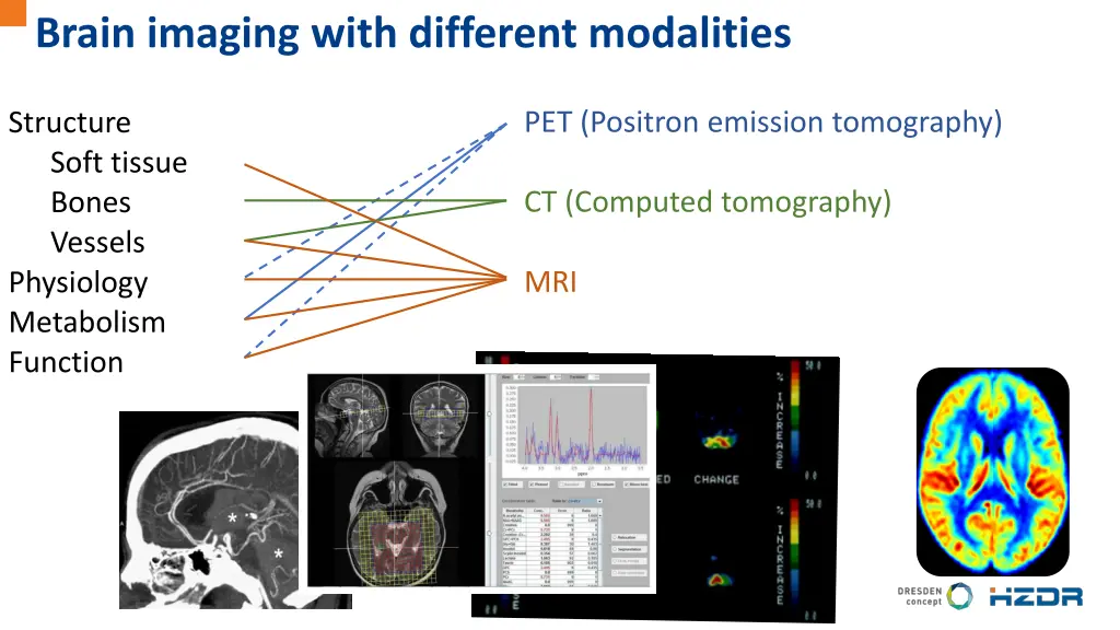 brain imaging with different modalities