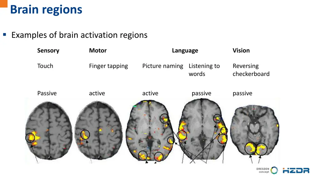 brain regions 1