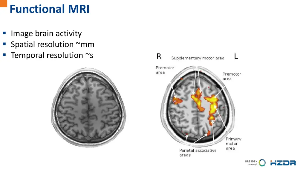 functional mri