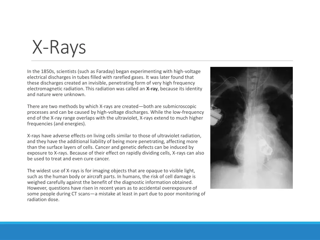 x rays