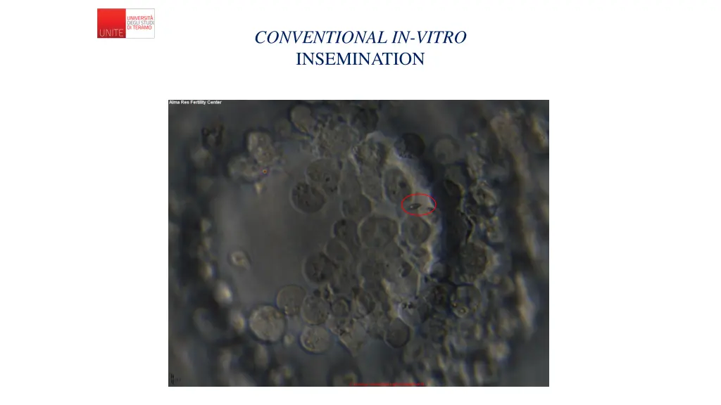 conventional in vitro insemination 1