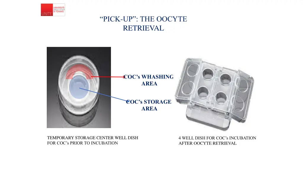 pick up the oocyte retrieval 2