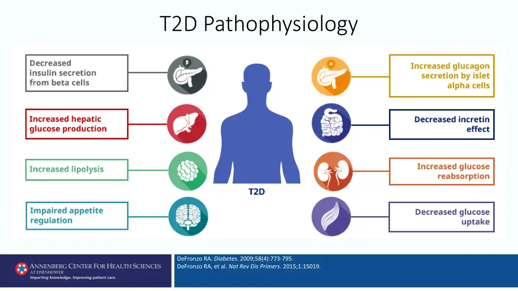 t2d pathophysiology