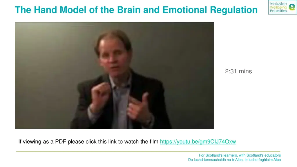 the hand model of the brain and emotional