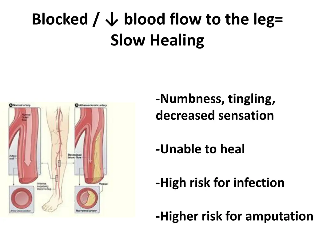 blocked blood flow to the leg slow healing