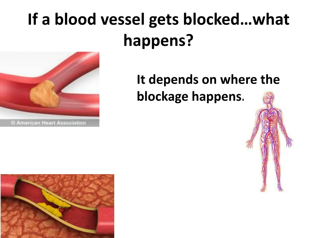 if a blood vessel gets blocked what happens