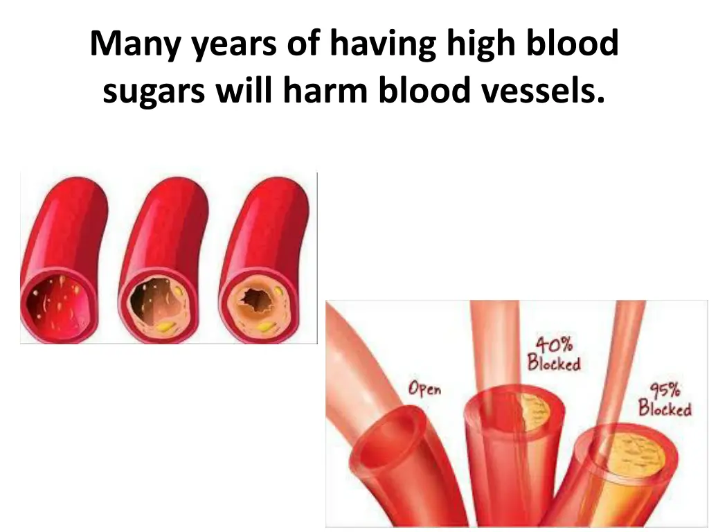 many years of having high blood sugars will harm