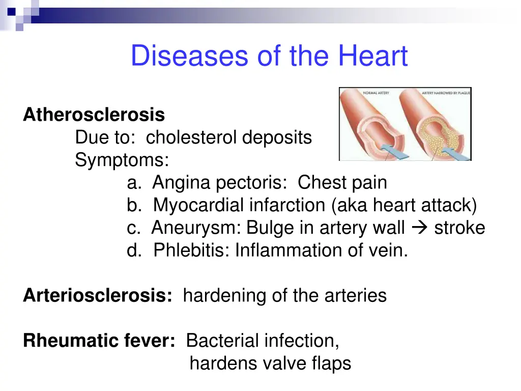 diseases of the heart