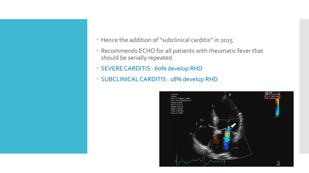 hence the addition of subclinical carditis in 2015