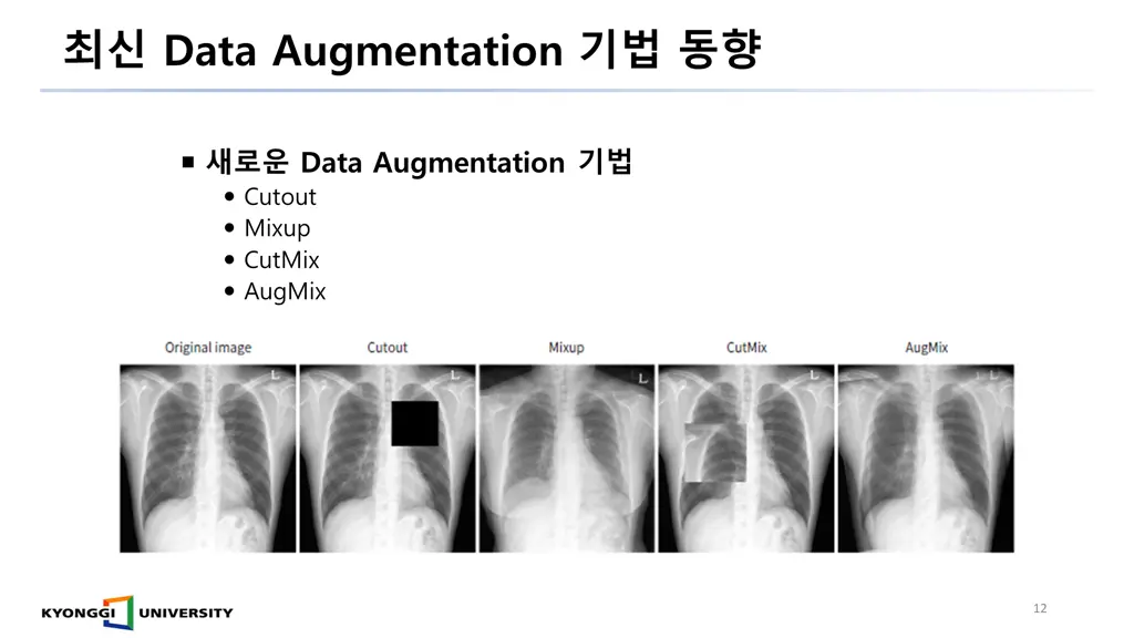 data augmentation