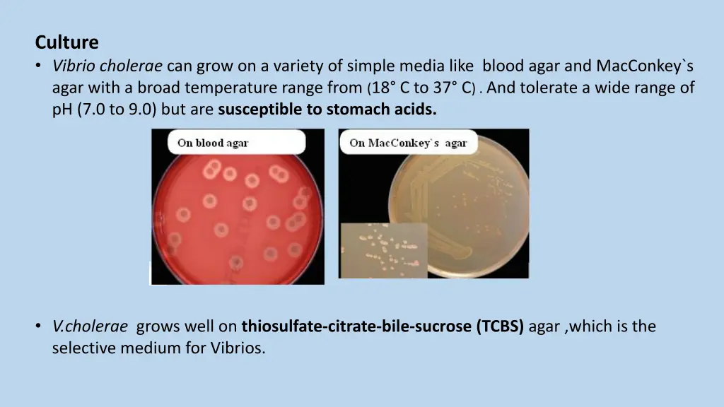 culture vibrio cholerae can grow on a variety