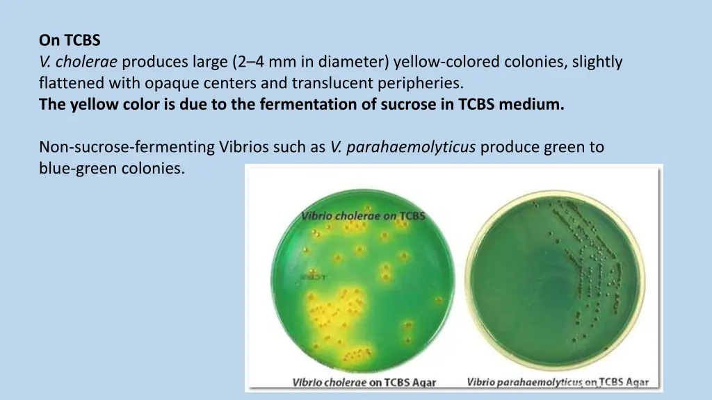 on tcbs v cholerae produces large