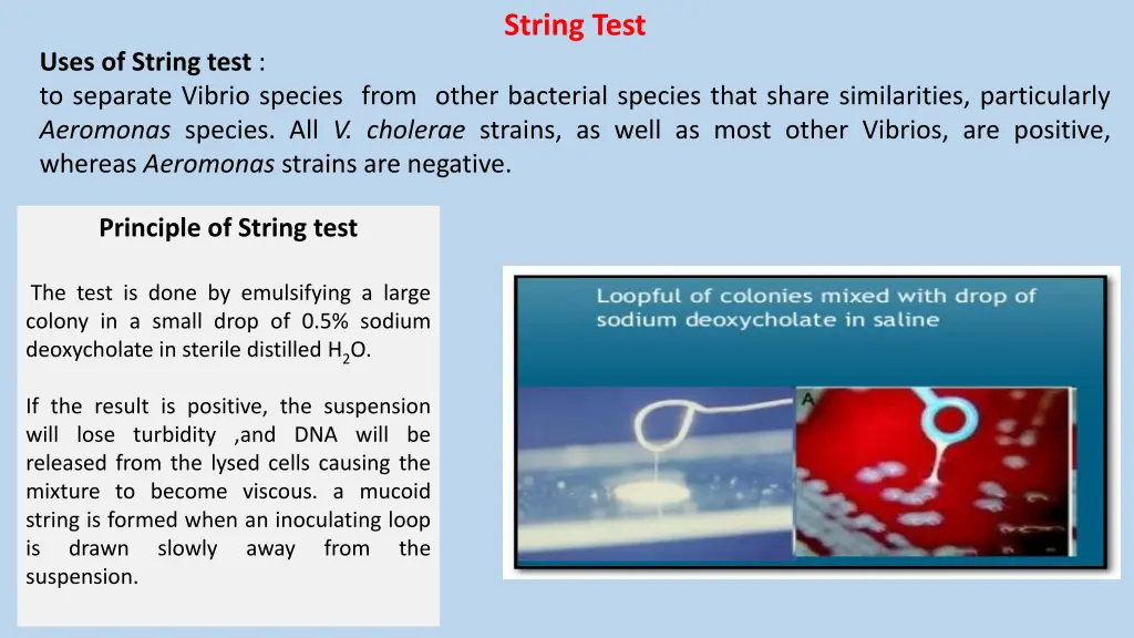 string test