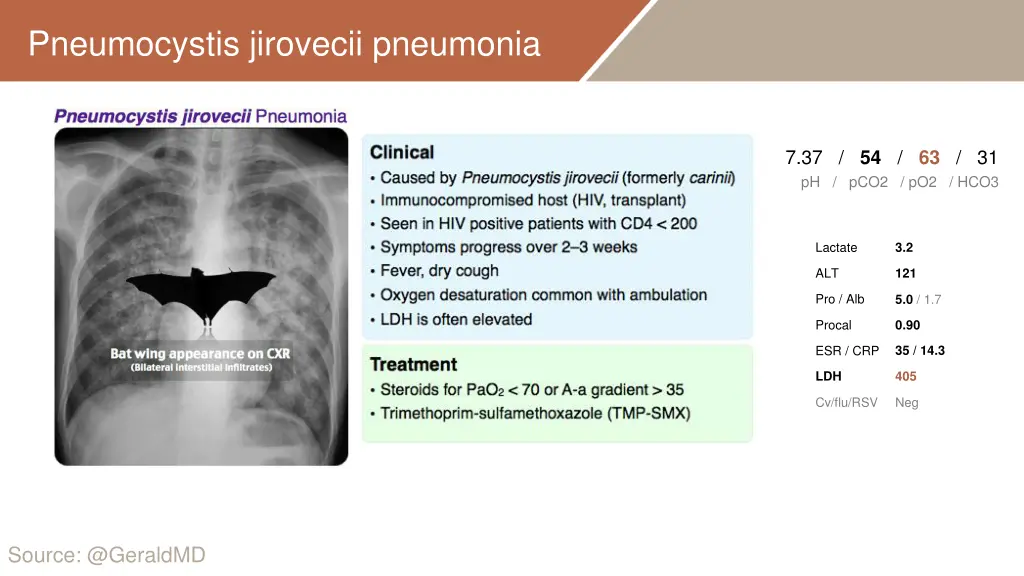 pneumocystis jirovecii pneumonia