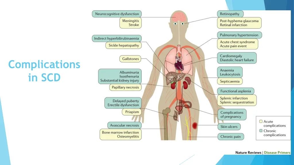 complications in scd