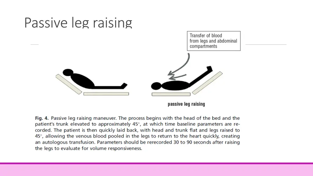 passive leg raising