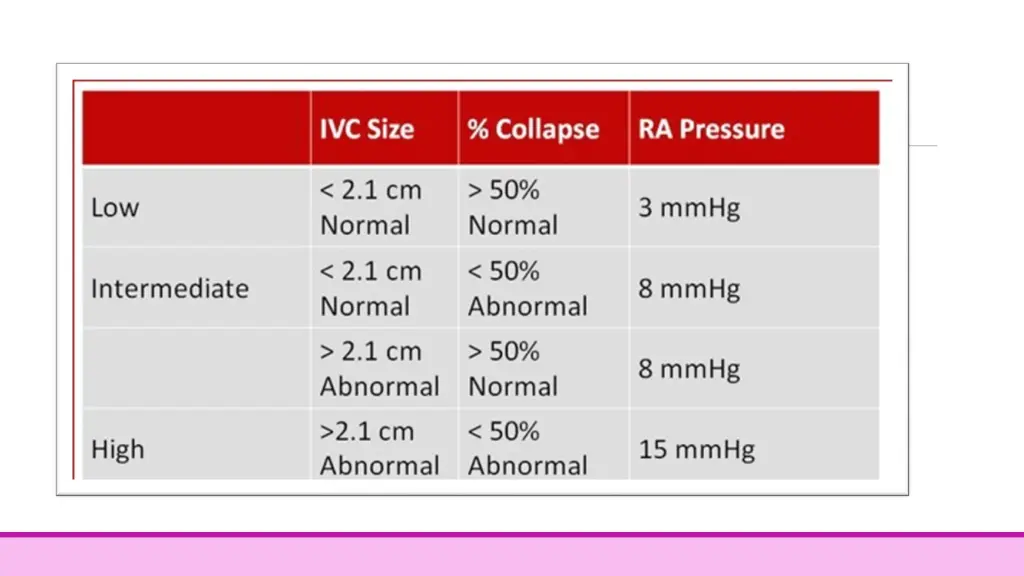 slide17