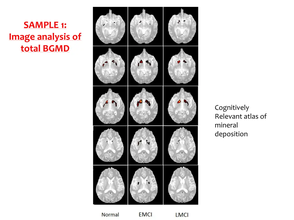 sample 1 image analysis of total bgmd