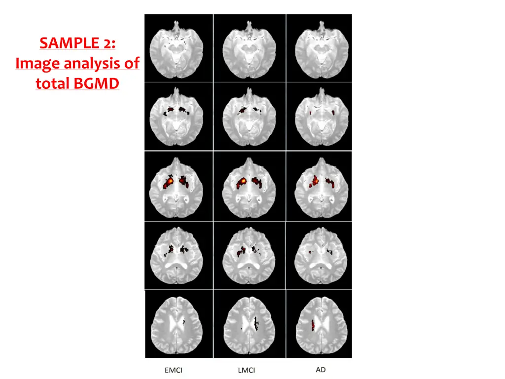 sample 2 image analysis of total bgmd