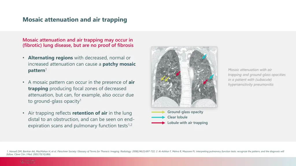 mosaic attenuation and air trapping