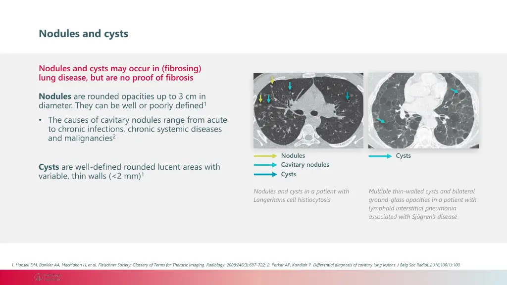 nodules and cysts