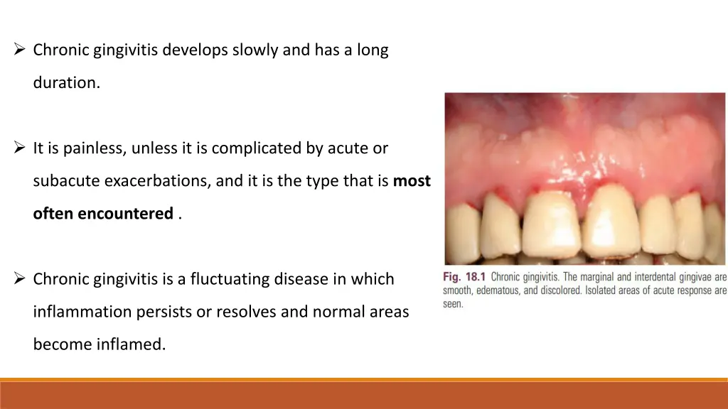 chronic gingivitis develops slowly and has a long