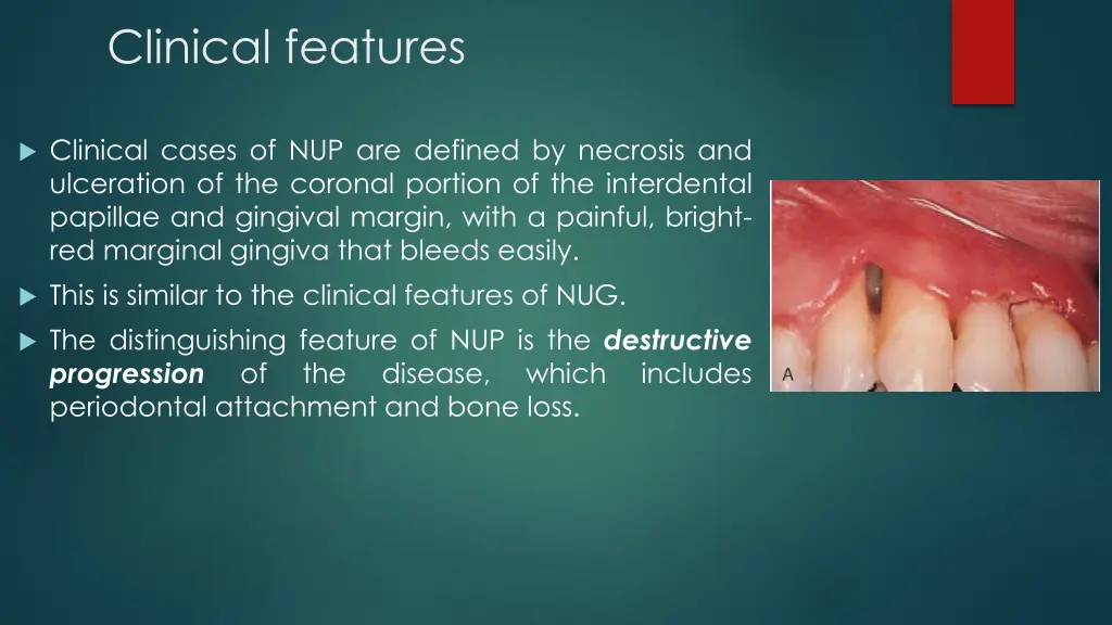 clinical features 1