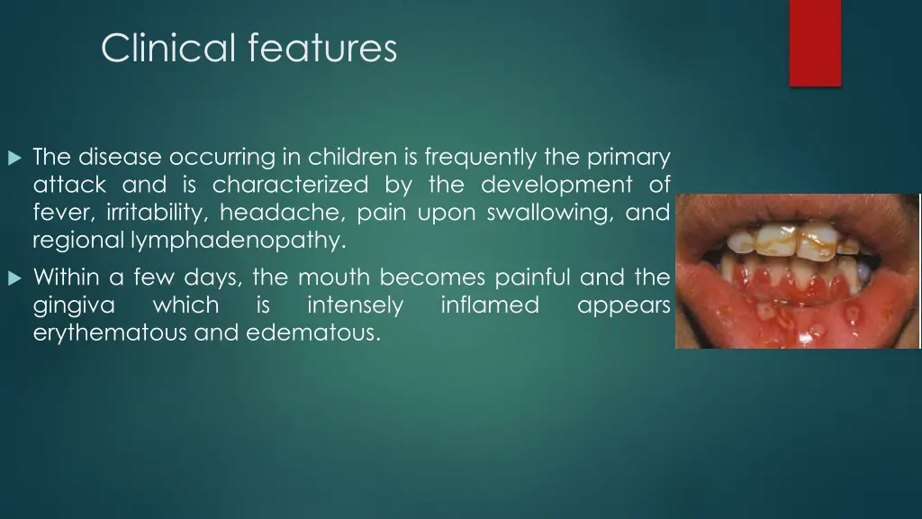 clinical features 2