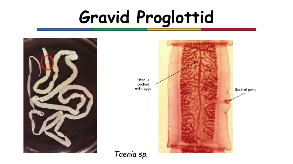 gravid proglottid