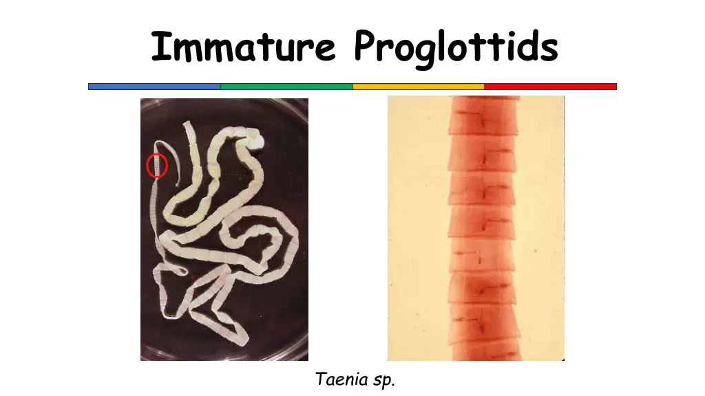 immature proglottids