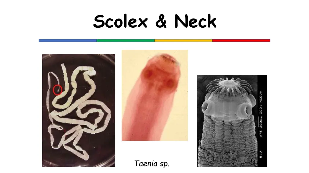 scolex neck