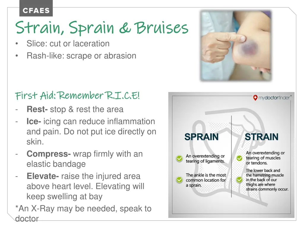 strain sprain bruises strain sprain bruises