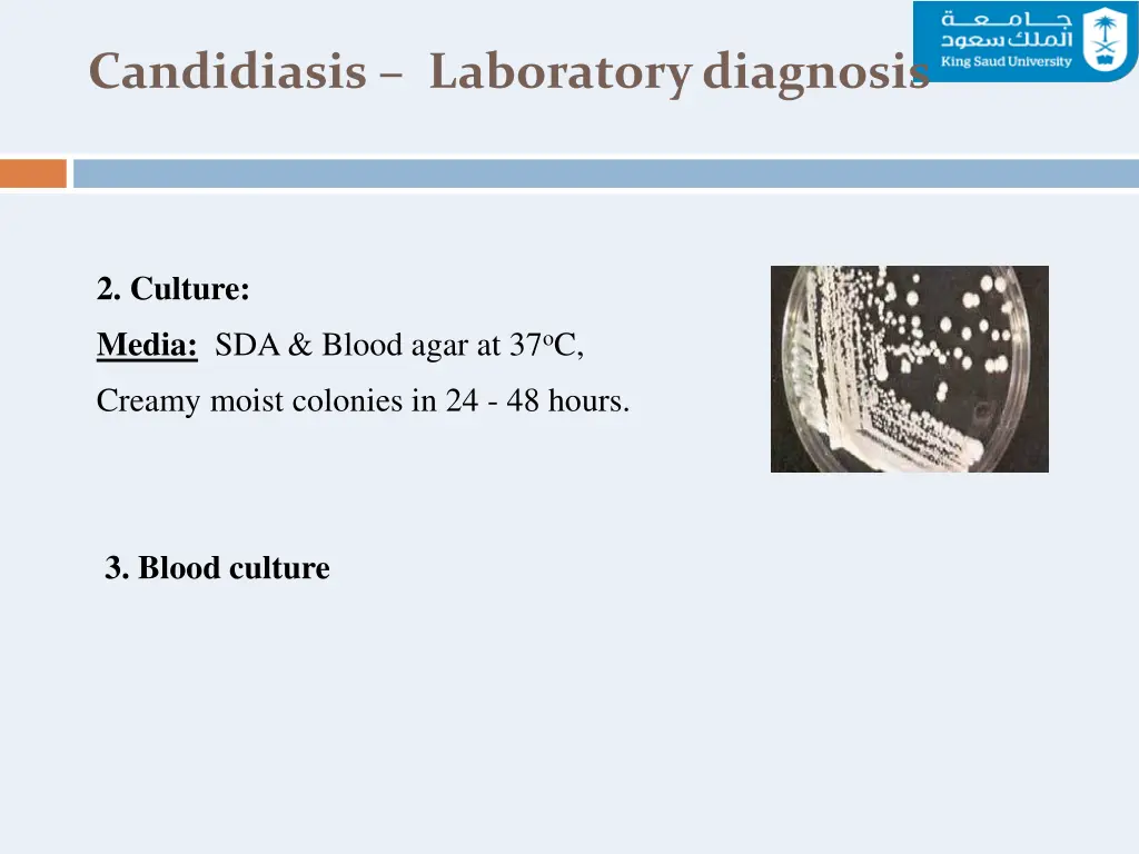 candidiasis laboratory diagnosis 1