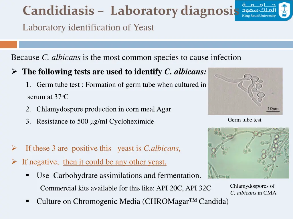 candidiasis laboratory diagnosis laboratory