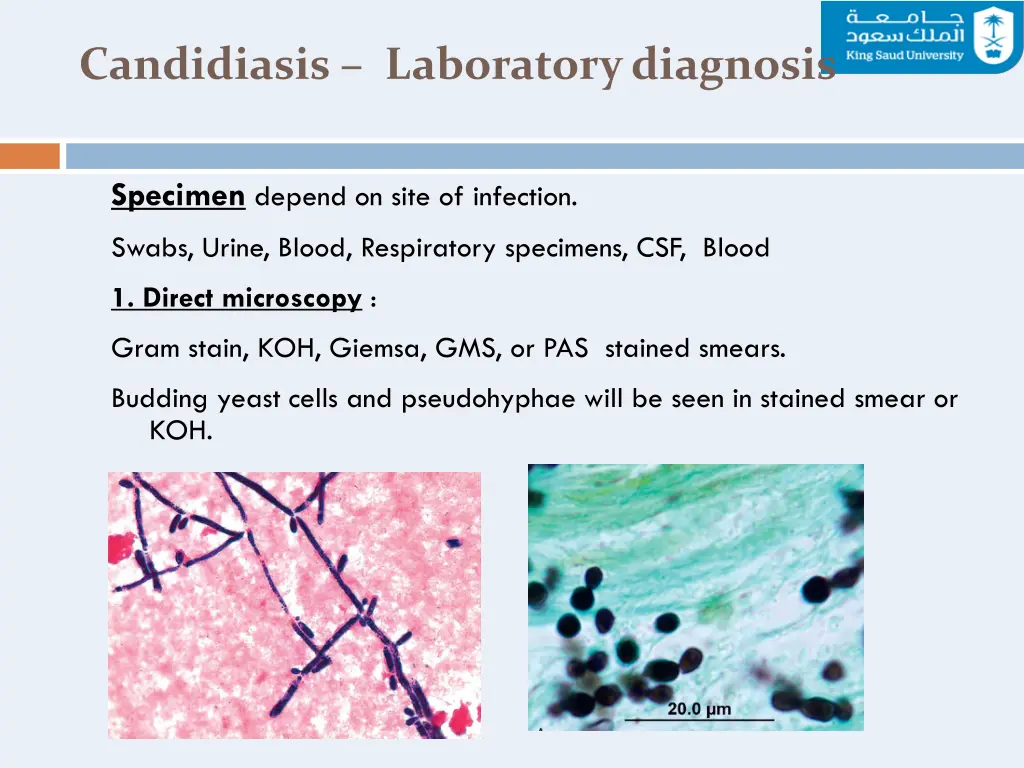 candidiasis laboratory diagnosis