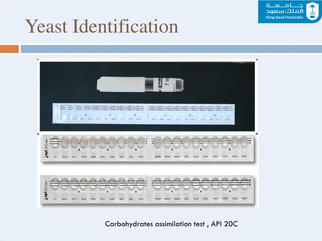 yeast identification