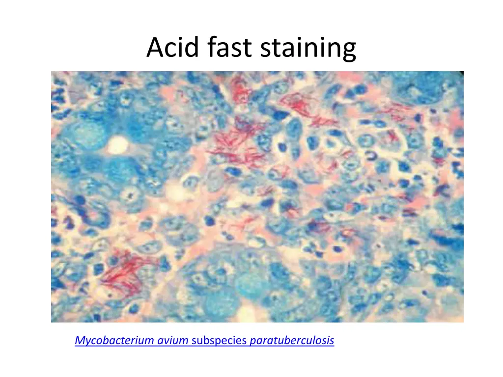 acid fast staining