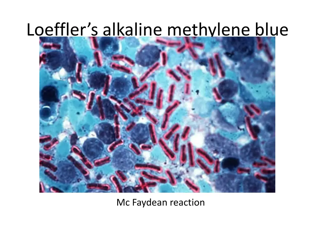 loeffler s alkaline methylene blue