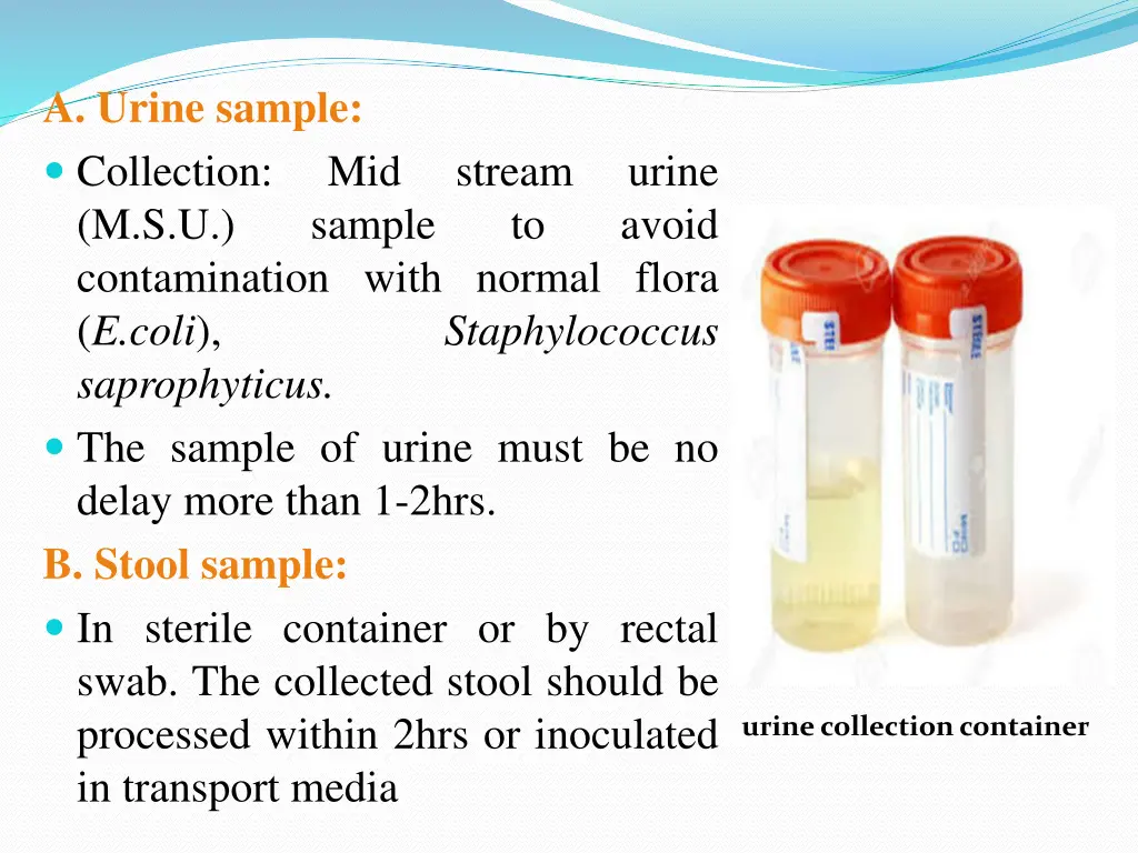 a urine sample collection m s u contamination