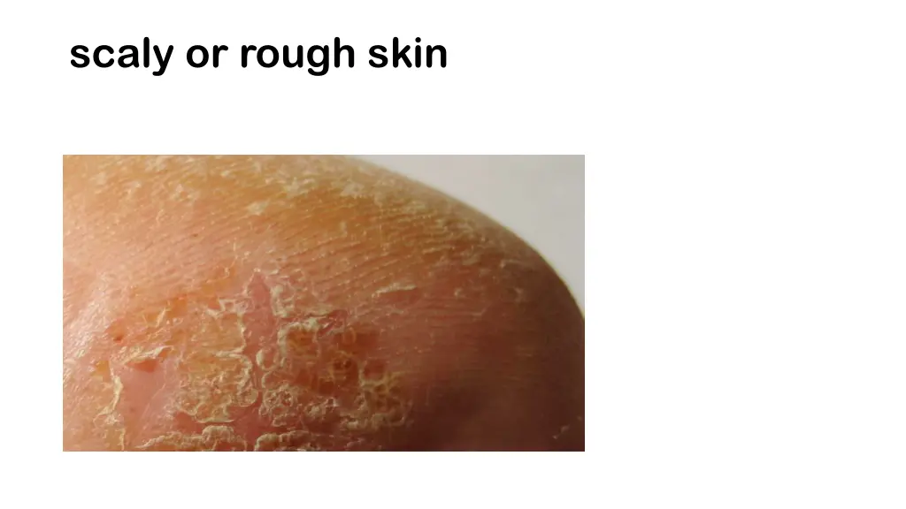 scaly or rough skin