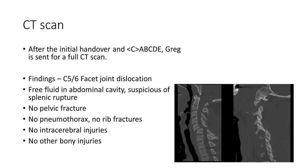 ct scan