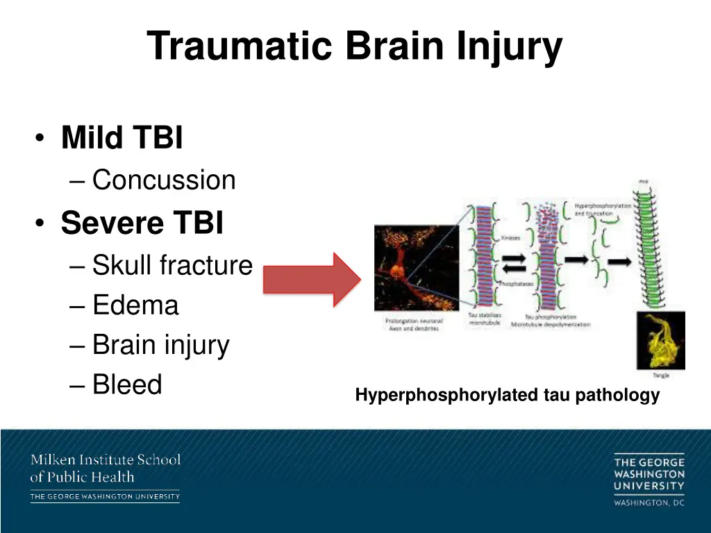 traumatic brain injury