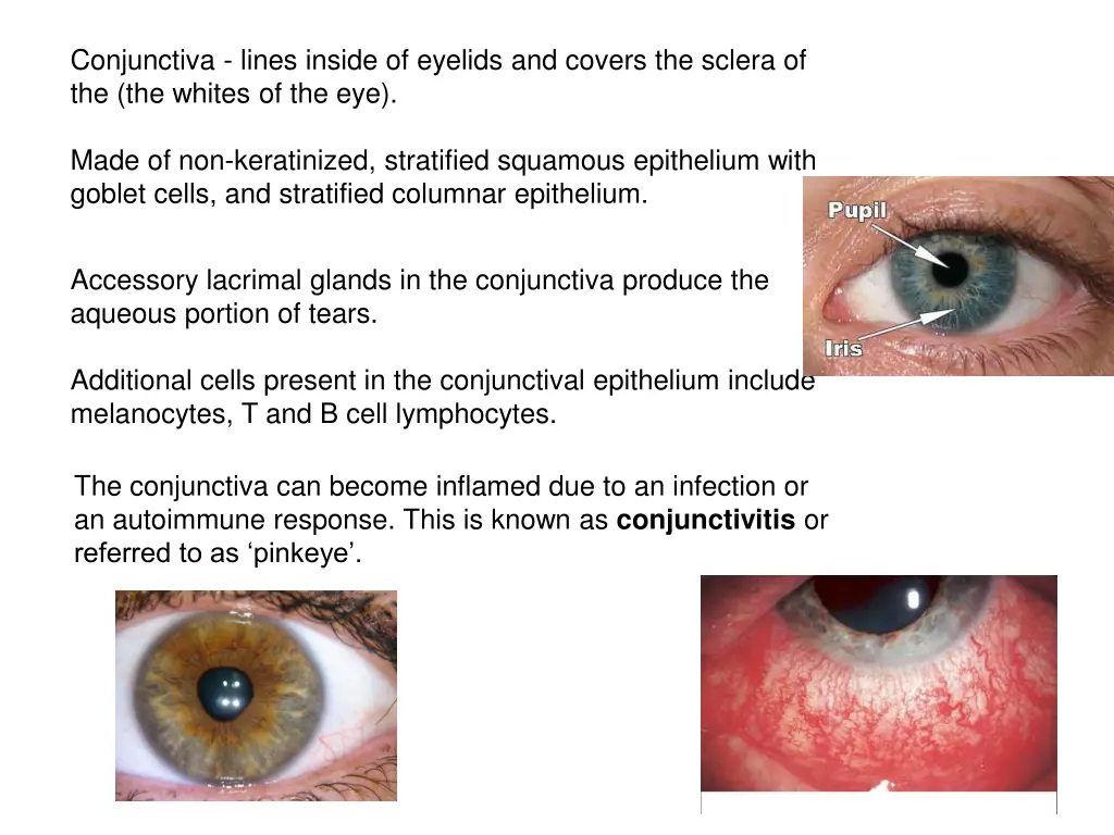 conjunctiva lines inside of eyelids and covers