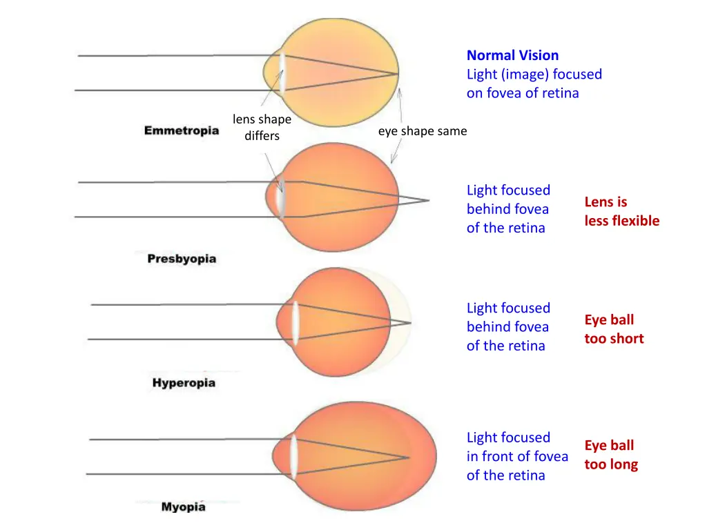 normal vision light image focused on fovea