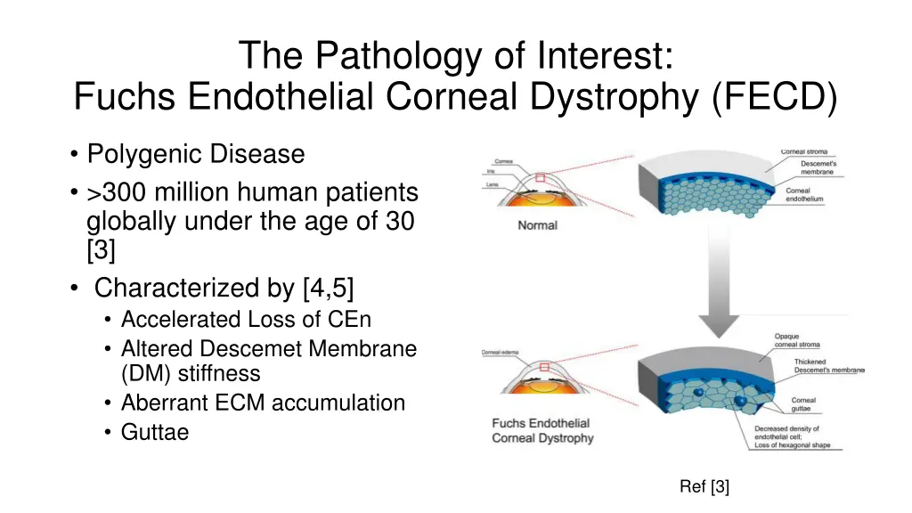 the pathology of interest fuchs endothelial 2