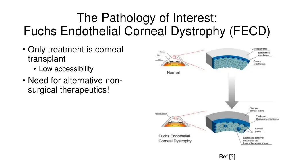 the pathology of interest fuchs endothelial 3