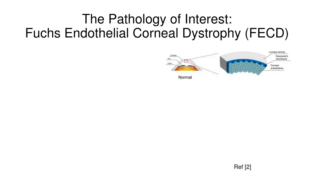 the pathology of interest fuchs endothelial