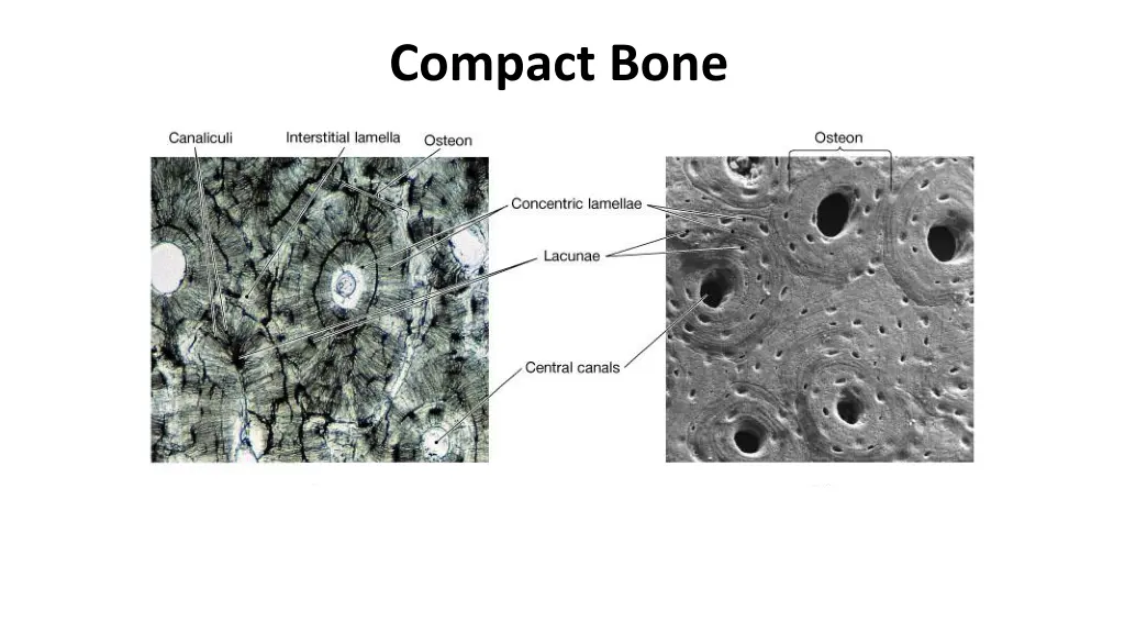 compact bone