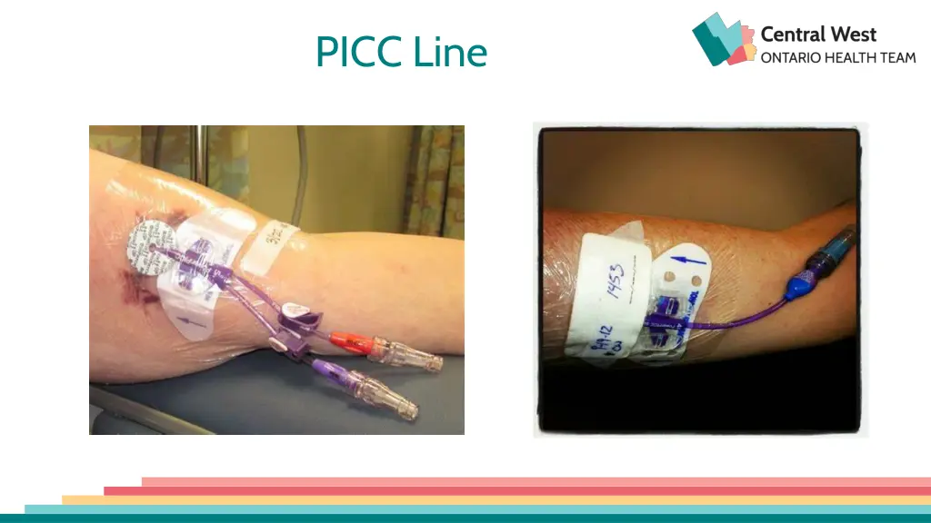 picc line