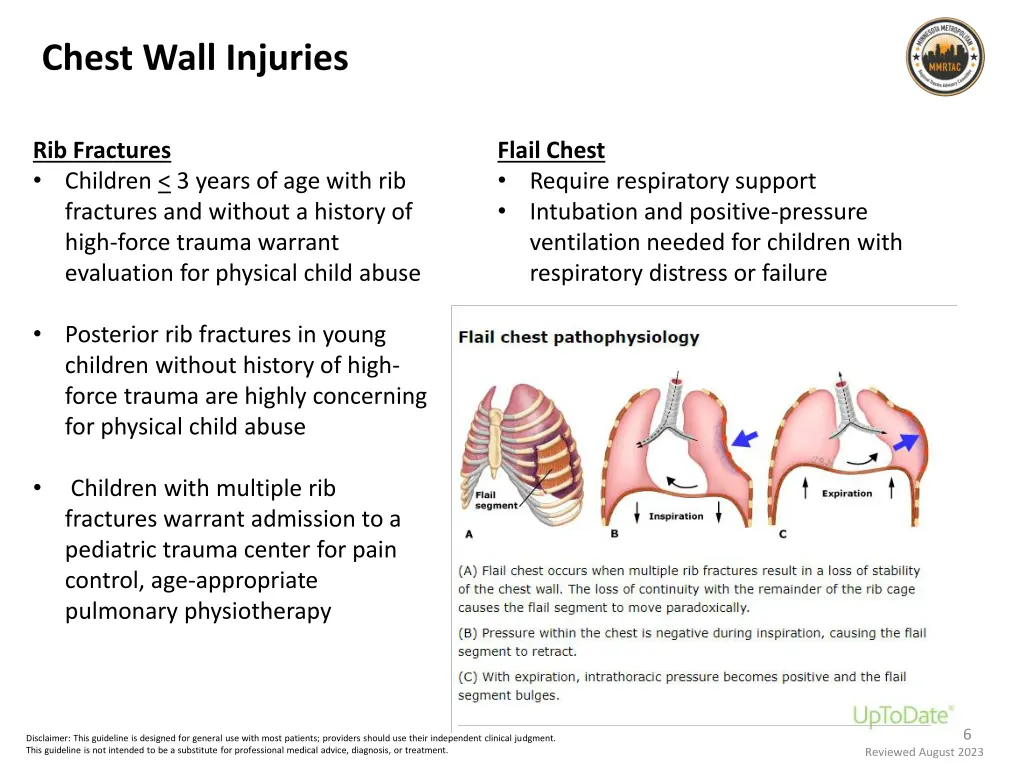 chest wall injuries